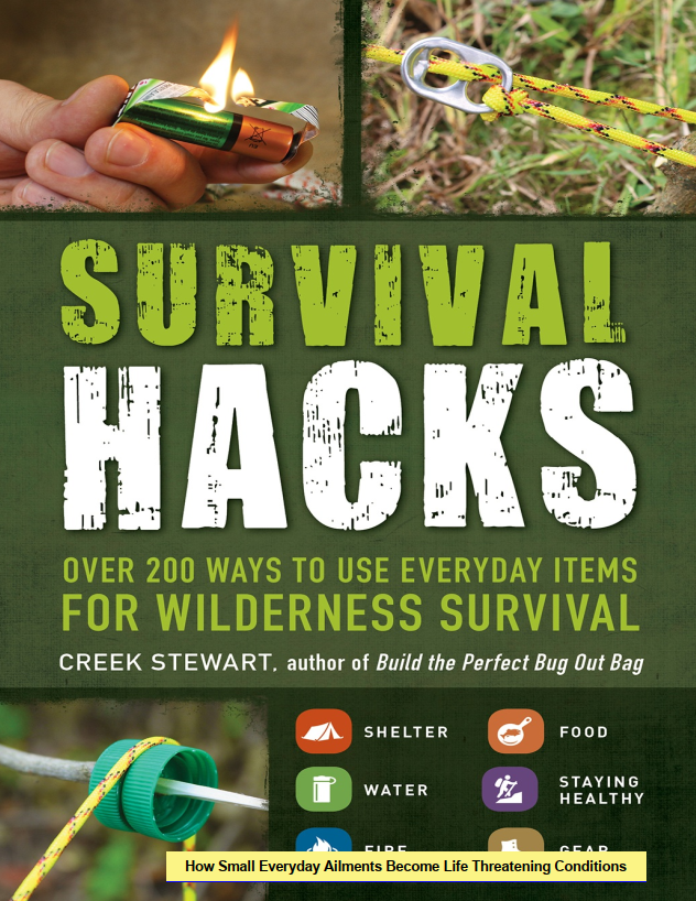 Survival Hacks! 200 Ways to Use Everyday Items for Wilderness Survival!